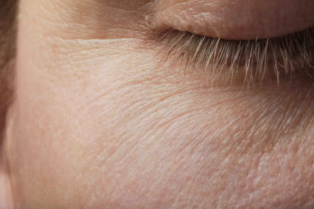 Woman with eye closed